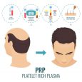What is The PRP Treatment For Skin and Hair?